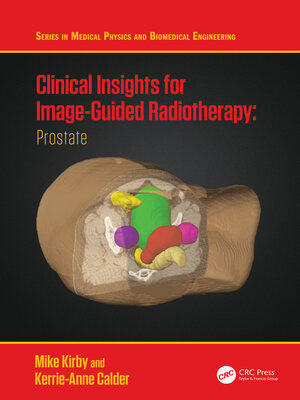 cover image of Clinical Insights for Image-Guided Radiotherapy